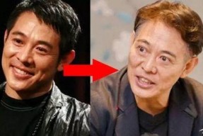 甲亢眼球突出图片,揭示甲状腺功能亢进与眼部病变的关联